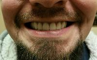 Premier Dentures image 2